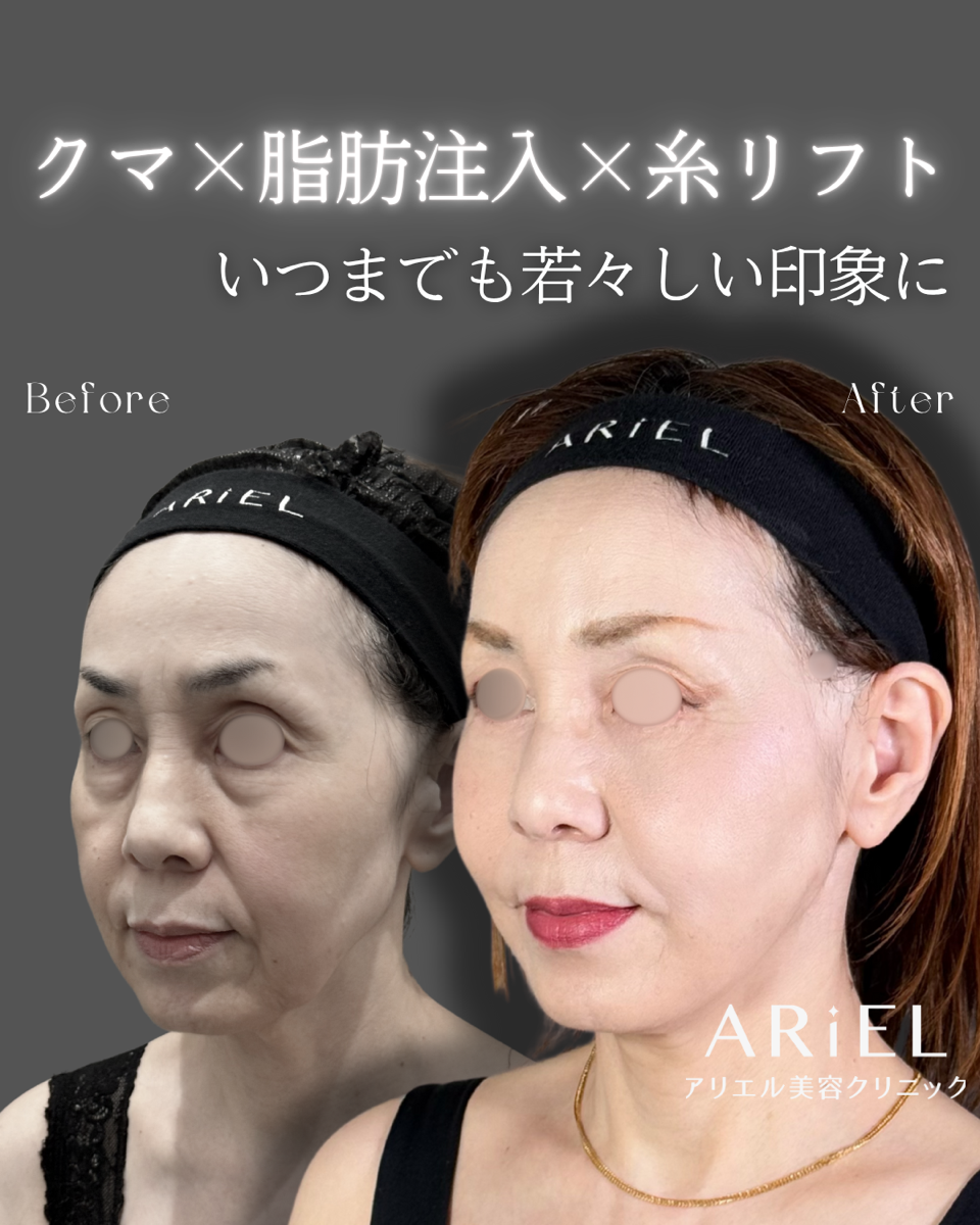 No.9138の症例写真